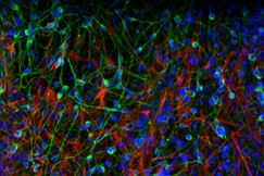 SA scientists in stem cell breakthrough SA scientists in stem cell breakthrough