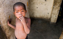 Poor child poverty, non-income poverty, income poverty, welfare, social welfare, pro-
poor, basic services